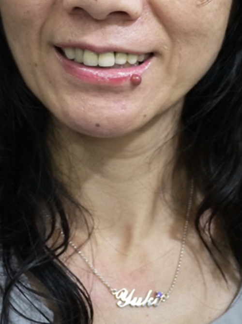 P1000260.JPG P1000260.JPG