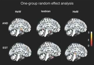 fmrilw.jpg fmrilw.jpg