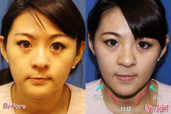 c加亮拷貝 c加亮拷貝