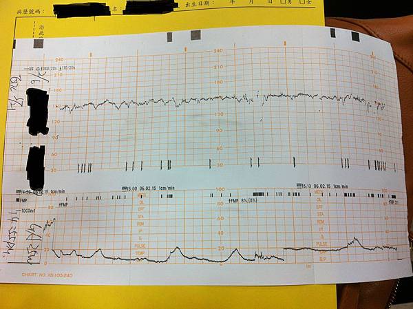 2015/02/06 臍帶繞頸