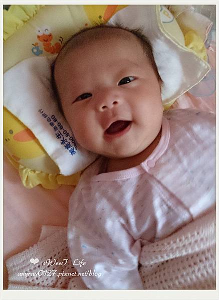 舌繫帶紀錄((痛)) (12).jpg 舌繫帶紀錄((痛)) (12).jpg