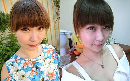 Ulthera超音波拉提體驗 - 追求臉的極致線條~緊實拉提讓臉更上鏡!!.jpg