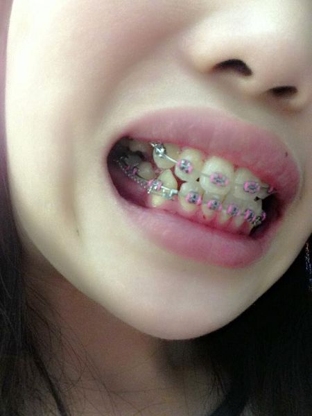 1010162_10201537679514745_1228399656_n