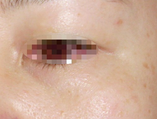 SL376442.JPG SL376442.JPG