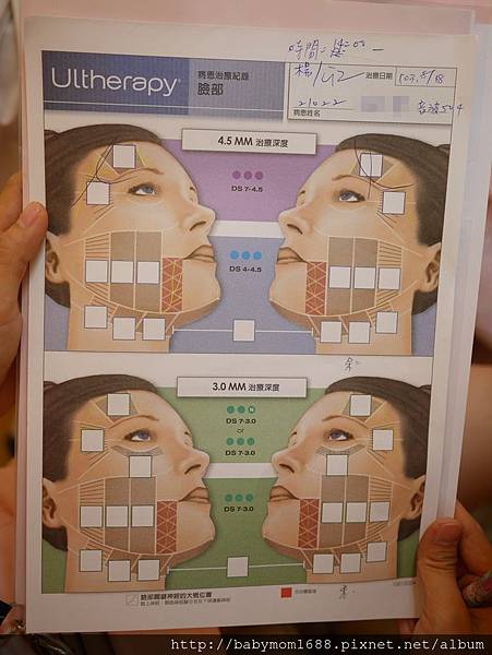 【極線音波拉提】星采皮膚專科診所(古亭)-30拉警報之~傳說中的Ultherapy極線音波拉提_貝貝媽