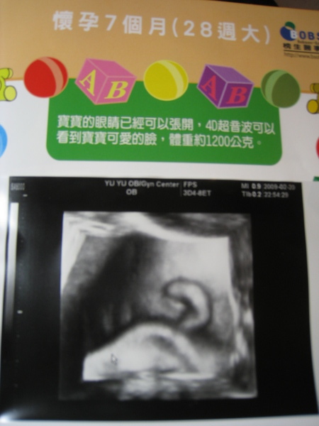 傳說中耳朵的超音波.. 傳說中耳朵的超音波..