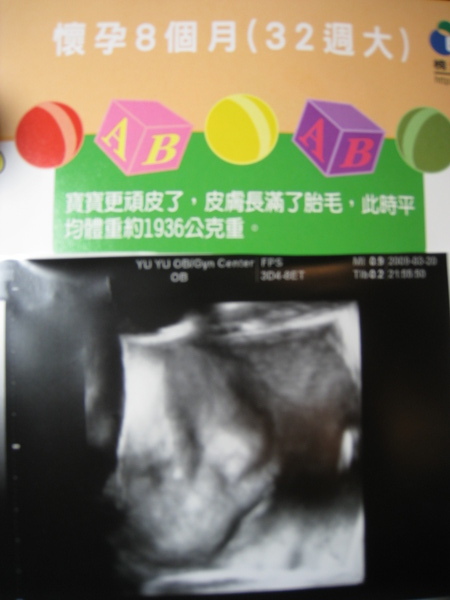 一直被醫生說胖胖的小臉.. 一直被醫生說胖胖的小臉..