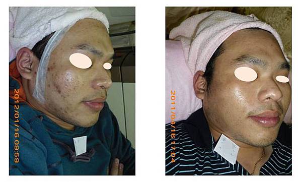 ãéºå§¿ å¾®æ´ãçåçæå°çµæ