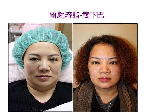 雙下巴-簡淑照 雙下巴-簡淑照