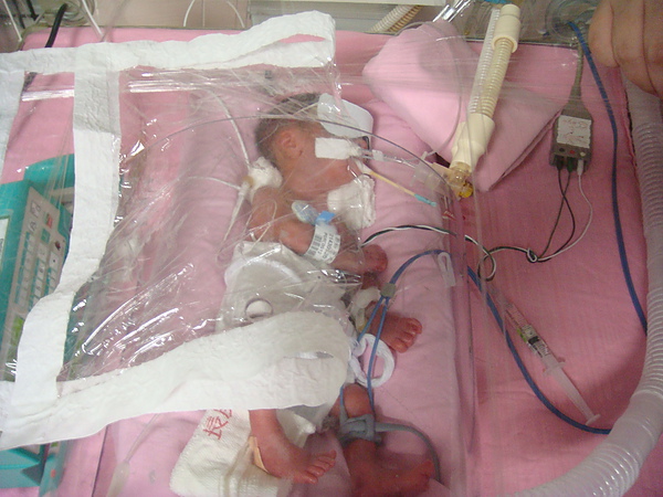 被包在保鮮膜裡面