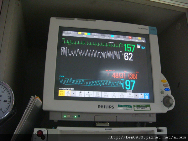 vial sign data is good