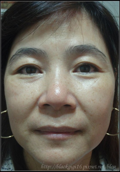 SAMUI胎盘精华,不只是针对抗老防皱,连雀斑都