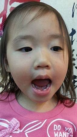 103.04.28亮亮拔牙 (8).jpg 103.04.28亮亮拔牙 (8).jpg