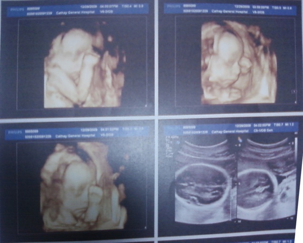 23W6D 高層次超音波檢查02.jpg