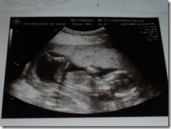 20080604-1 20080604-1