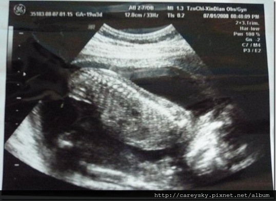 20080806-1 20080806-1