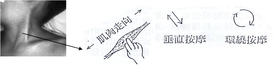 頭斜頸18.jpg