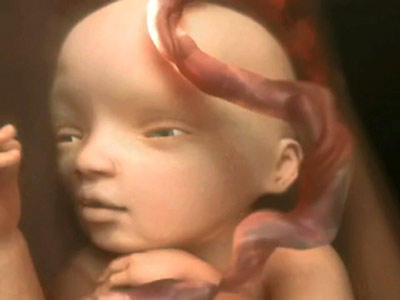 video_thumb_eyesight_color