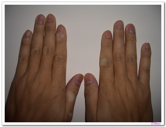 无名指比食指长的男性更能赚钱@+平凡幸福简