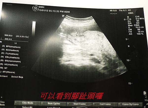 二寶記事~懷孕前五個月整理