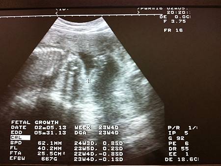 IMG_3223 IMG_3223