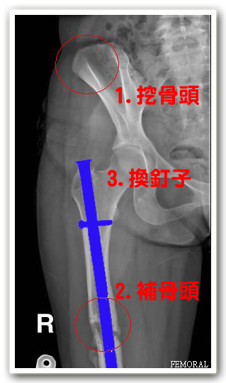 骨頭.jpg