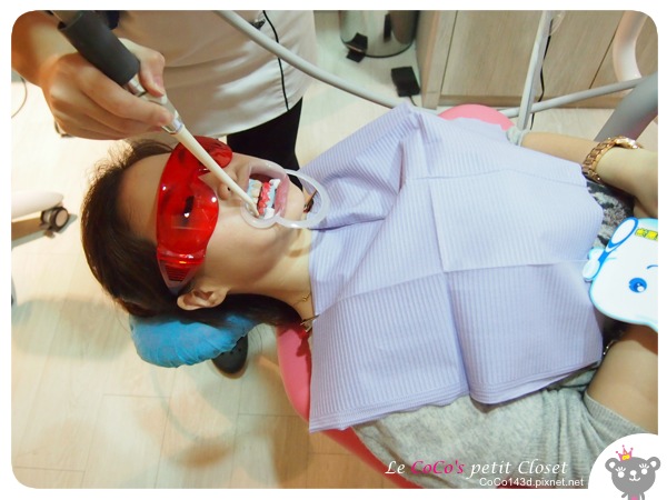 whitening15