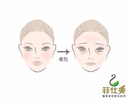 台中自體脂肪移植豐頰自體脂肪移植補臉台中菲仕美 台中自體脂肪移植豐頰自體脂肪移植補臉台中菲仕美