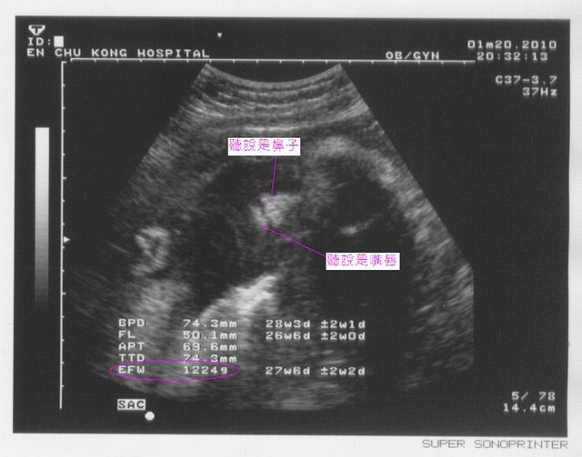 28週又5天.jpg