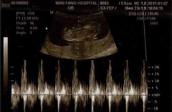 288107_259816550711825_100000504463307_1124876_7292003_o