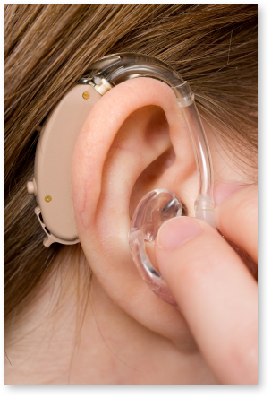 類比式助聽器 5 類比式助聽器 5