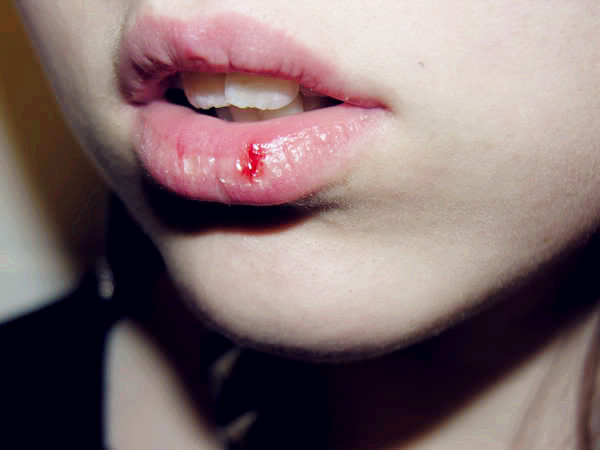 嘴唇上表面长一些小小的东西是什么,怎么办