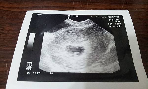 20121215_140518 20121215_140518