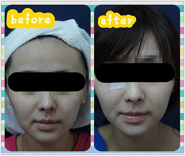 林軒語101.8.22 MISJU前 (1)_副本_副本 林軒語101.8.22 MISJU前 (1)_副本_副本