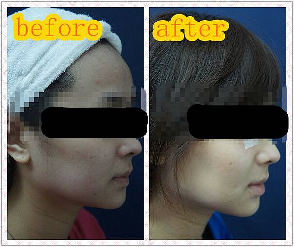 林軒語101.8.22 MISJU前 (6)_副本 林軒語101.8.22 MISJU前 (6)_副本