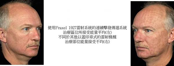 1927-4(1) 1927-4(1)
