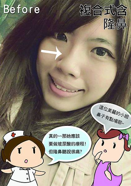 隆鼻01.jpg