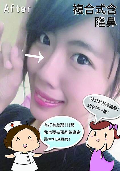 隆鼻03.jpg