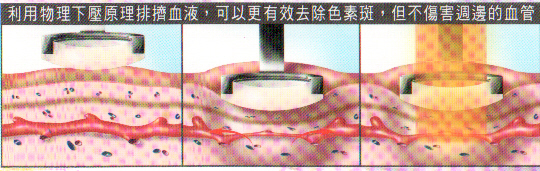 skf91B9.jpg skf91B9.jpg