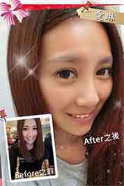 台中朵特菈醫美整形