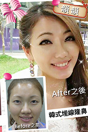 台中朵特菈醫美整形