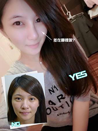 4D隆鼻01 4D隆鼻01