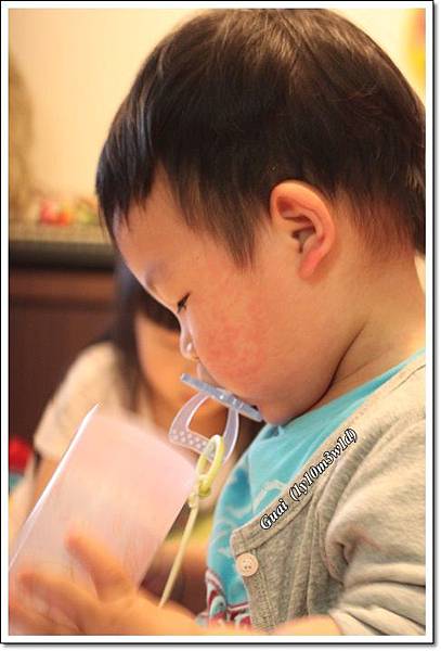 乖玫瑰疹第三天