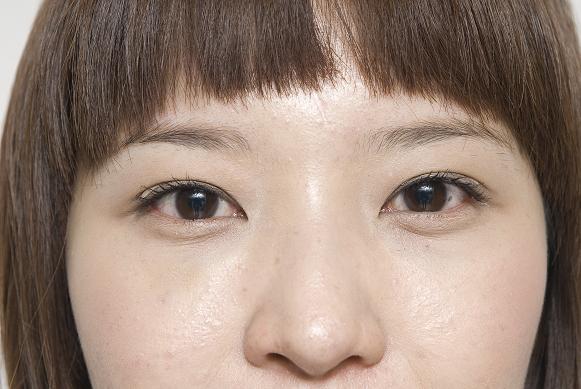 YUN_4037.jpg YUN_4037.jpg
