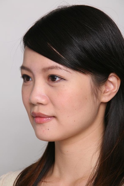 YES:把鼻樑打高、加強鼻額角,連額頭也飽滿了!.JPG YES:把鼻樑打高、加強鼻額角,連額頭也飽滿了!.JPG