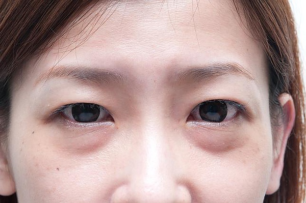YUN_1247.jpg YUN_1247.jpg