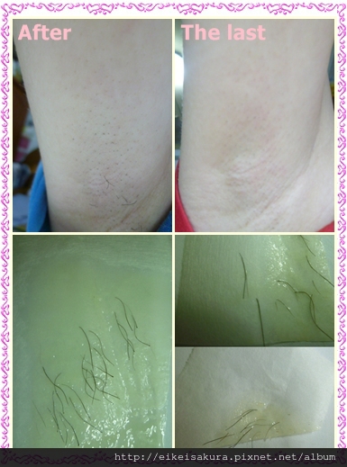 蓓-脫毛蠟紙08 試用