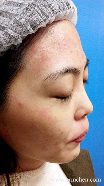 醫美護膚skin004_副本.jpg 醫美護膚skin004_副本.jpg