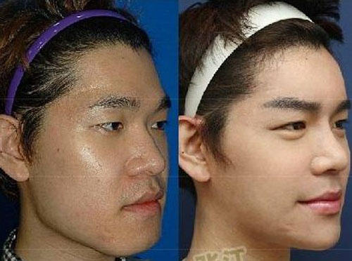 削骨0 削骨0