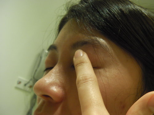 【角膜塑型片】位移時的處理方式:台北專業驗配 角膜塑型片 大